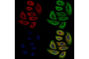 ABIN7094863 and ABIN7098915 staining Hela cells by IF/ICC.