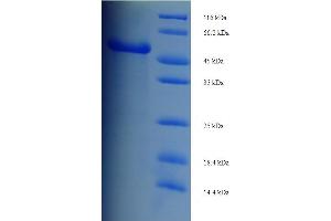 SDS-PAGE (SDS) image for Wingless-Type MMTV Integration Site Family, Member 3 (WNT3) (AA 22-355) protein (His-SUMO Tag) (ABIN5710624)