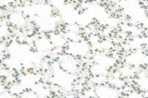 Immunohistochemistry analysis of paraffin-embedded rat lung using,RPAP2 (ABIN7075481) at dilution of 1: 1000