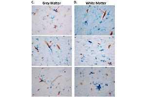 Representative images of collagen IV (brown) and GPR39 (blue) (ABIN1048812) labeling in human dlPFC grey, C, and white matter, D, arrows indicate colocalization of GPR39 with collagen IV, arrowheads indicate close proximity of GPR39 with collagen IV.