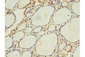 Immunohistochemistry of paraffin-embedded human thyroid tissue using ABIN7142322 at dilution of 1:100 (ACAA1 anticorps  (AA 27-331))