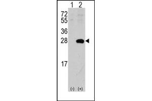 Image no. 1 for anti-sigma Non-Opioid Intracellular Receptor 1 (SIGMAR1) (N-Term) antibody (ABIN357896) (SIGMAR1 anticorps  (N-Term))