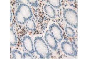 IHC-P analysis of Human Stomach Tissue, with DAB staining. (TNF alpha anticorps  (AA 77-233))