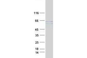 Validation with Western Blot