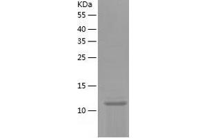Western Blotting (WB) image for Prolactin-Induced Protein (PIP) (AA 29-146) protein (His tag) (ABIN7124589) (PIP Protein (AA 29-146) (His tag))
