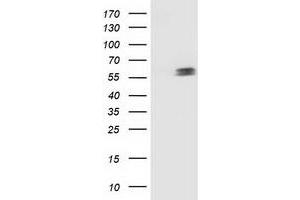 Western Blotting (WB) image for anti-Tumor Protein P53 (TP53) antibody (ABIN1499970)