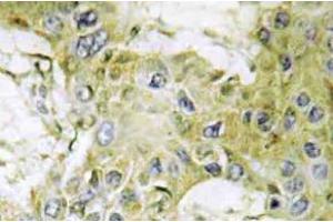 Immunohistochemistry (IHC) analyzes of Casein Kinase Igamma1 antibody in paraffin-embedded human brain tissue. (CSNK1G1 anticorps)