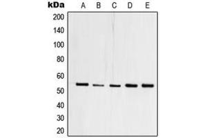 Western blot analysis of TFDP1 expression in HEK293T (A), A431 (B), Raji (C), mouse heart (D), PC12 (E) whole cell lysates. (DP1 anticorps  (C-Term))