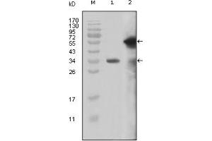 Western Blotting (WB) image for anti-Myeloid/lymphoid Or Mixed-Lineage Leukemia (MLL) (AA 3751-3968) antibody (ABIN2464083) (MLL/KMT2A anticorps  (AA 3751-3968))