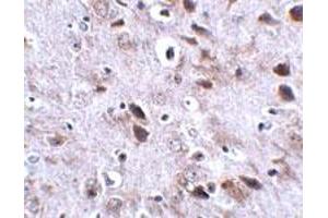 Immunohistochemical staining of mouse brain tissue with 2. (Transmembrane Protein 18 (TMM18) (C-Term) anticorps)