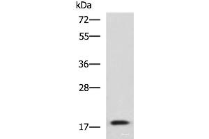 Western blot analysis of Human fetal liver tissue lysate using IL1B Polyclonal Antibody at dilution of 1:800 (IL-1 beta anticorps)