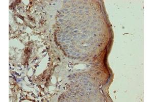 Immunohistochemistry of paraffin-embedded human skin tissue using ABIN7161852 at dilution of 1:100