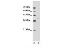 Image no. 1 for anti-Keratin 13 (KRT13) (C-Term) antibody (ABIN203408)