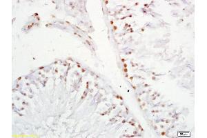 Formalin-fixed and paraffin embedded rat testis labeled with Anti-XAGE2 Polyclonal Antibody, Unconjugated (ABIN721750) at 1:200 followed by conjugation to the secondary antibody and DAB staining. (XAGE2 anticorps  (AA 30-70))