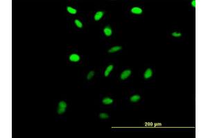 Immunofluorescence of purified MaxPab antibody to RRN3 on HeLa cell. (RRN3 anticorps  (AA 1-106))