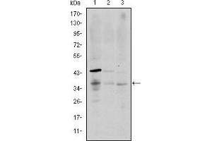Western blot analysis using CD1A mouse mAb against K562 (1), RAJI (2), and MOLT4 (3) cell lysate.