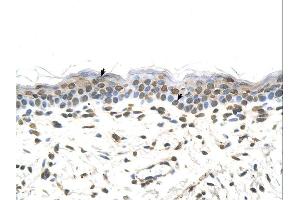 Immunohistochemistry (IHC) image for anti-Formiminotransferase Cyclodeaminase (FTCD) (Middle Region) antibody (ABIN2776888)