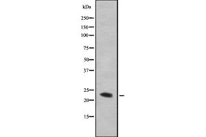 Western blot analysis GAAP using HepG2 whole cell lysates (TMBIM4 anticorps  (N-Term))