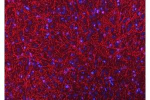 IF analysis of CNPase/CNP using anti-CNPase/CNP antibody (ABIN7599377).