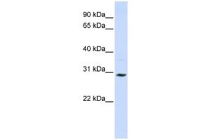 SLC25A20 antibody used at 1 ug/ml to detect target protein. (SLC25A20 anticorps)