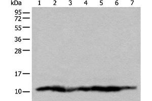 Western blot analysis of 293T cell lysates using UQCRQ Polyclonal Antibody at dilution of 1:450 (UQCRQ anticorps)