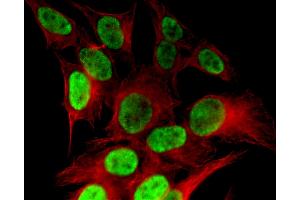 Histone H4K8ac antibody (pAb) tested by immunofluorescence. (Histone H4 anticorps  (acLys8))