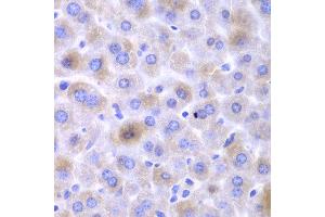 Immunohistochemistry of paraffin-embedded mouse liver using EPHX1 antibody at dilution of 1:100 (400x lens). (EPHX1 anticorps)