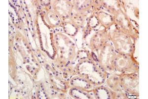 Formalin-fixed and paraffin embedded human kidney labeled with Anti-SLC12A3 Polyclonal Antibody, Unconjugated (ABIN872340) at 1:200 followed by conjugation to the secondary antibody and DAB staining