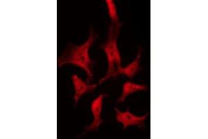 ABIN6268771 staining 293 by IF/ICC. (TYK2 anticorps  (C-Term))