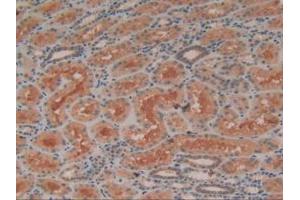 IHC-P analysis of Human Kidney Tissue, with DAB staining. (ADCY3 anticorps  (AA 501-736))