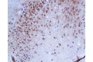 Formalin-fixed and paraffin embedded rat brain tissue with labeled Anti-Phospho-Estrogen Receptor alpha (Ser167) Polyclonal Antibody, Unconjugated  at 1:200, followed by conjugation to the secondary antibody and DAB staining
