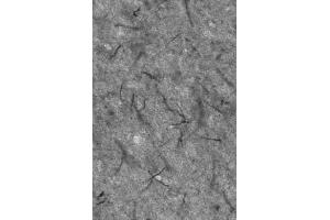 Adult rat thalamus immunohistochemistry of axon initial segments. (Ankyrin G anticorps)