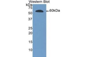 Western Blotting (WB) image for anti-Ribonuclease T2 (RNASET2) (AA 25-256) antibody (ABIN3209300) (RNASET2 anticorps  (AA 25-256))
