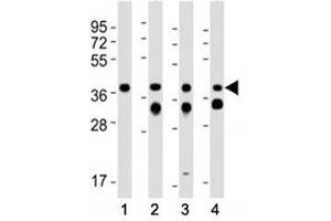Western blot testing of EpCAM antibody at 1:2000 dilution.