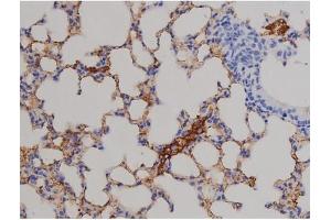 ABIN6267511 at 1/200 staining Mouse lung tissue sections by IHC-P.