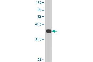 Western Blot detection against Immunogen (38.