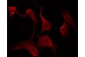 ABIN6276066 staining HeLa by IF/ICC.