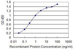 anti-Interleukin 1 Family Member 9 (IL1F9) (AA 1-110) antibody