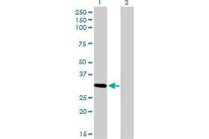 Western Blot analysis of ZNF124 expression in transfected 293T cell line by ZNF124 monoclonal antibody (M01), clone 4G4. (ZNF124 anticorps  (AA 121-229))