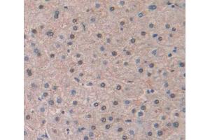Used in DAB staining on fromalin fixed paraffin- embedded Kidney tissue