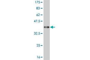 Western Blot detection against Immunogen (36. (FADS3 anticorps  (AA 16-113))