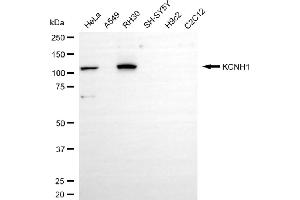 Western blotting analysis using KCNH1 antibody (ABIN7799885).