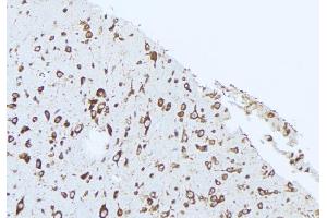 ABIN6274857 at 1/100 staining Rat brain tissue by IHC-P.