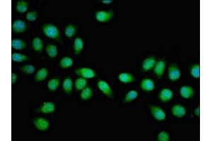 Immunofluorescent analysis of A549 cells using ABIN7154893 at dilution of 1:100 and Alexa Fluor 488-congugated AffiniPure Goat Anti-Rabbit IgG(H+L)
