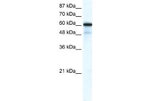 WB Suggested Anti-GABRA1 Antibody Titration:  0.