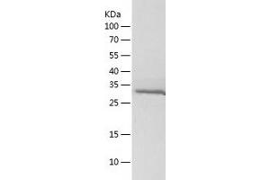 Western Blotting (WB) image for Aldo-Keto Reductase Family 1, Member D1 (AKR1D1) (AA 1-326) protein (His tag) (ABIN7121785) (AKR1D1 Protein (AA 1-326) (His tag))