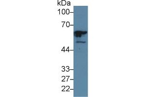 Detection of GTF2E1 in Human Hela cell lysate using Polyclonal Antibody to General Transcription Factor IIE, Polypeptide 1 (GTF2E1)