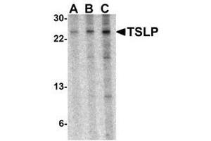Western blot analysis of TSLP in A-20 cell lysate with TSLP antibody at (A) 0. (Thymic Stromal Lymphopoietin anticorps)