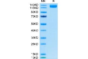 SARS-COV-2 Spike S1 on Tris-Bis PAGE under reduced condition.