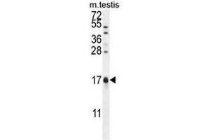 CAMK2N1 Antibody (C-term) western blot analysis in mouse testis tissue lysates (35µg/lane). (CAMK2N1 anticorps  (C-Term))